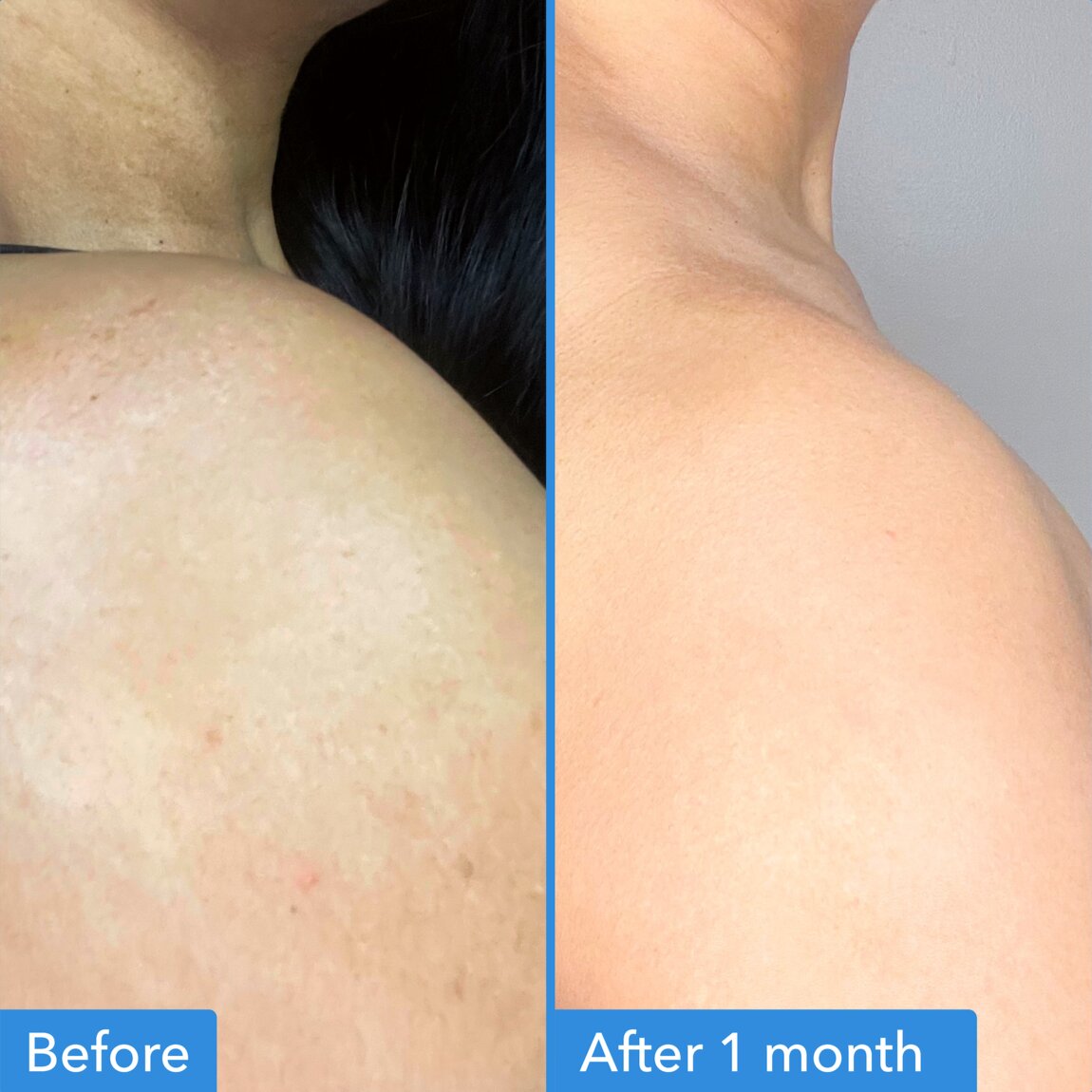 discoloration-correcting-body-treatment-g0 zb_p.jpg